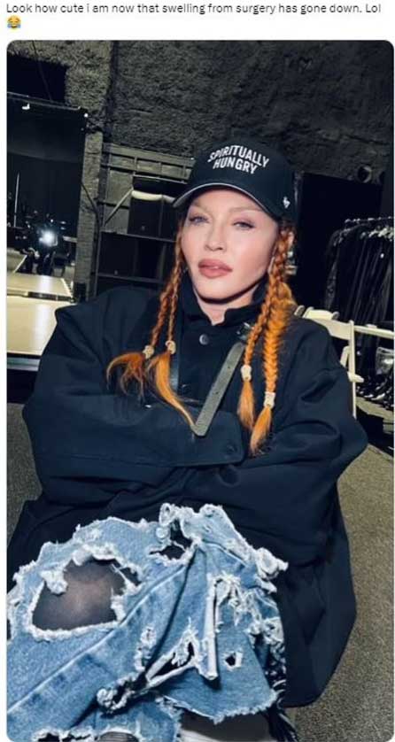 Madonna