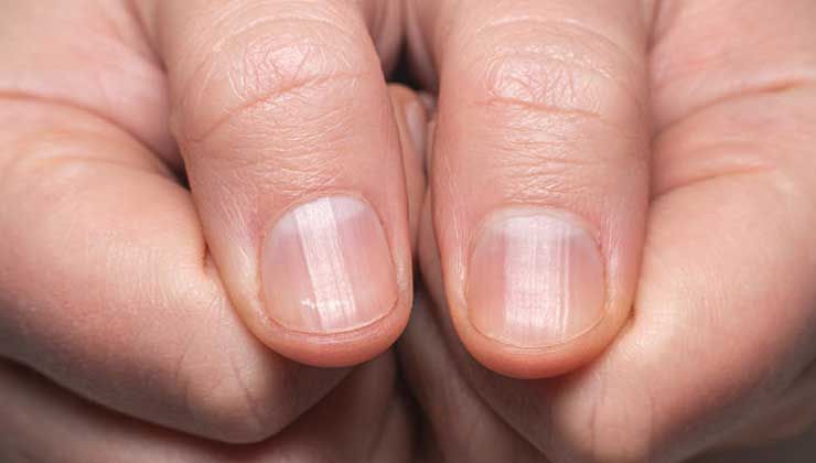 fingernails_JA4DG.jpg