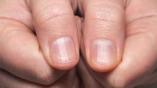 fingernails_JA4DG.jpg
